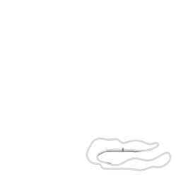 00_acopone